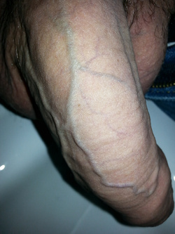 IO per coppia o Donna.