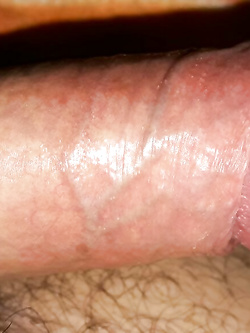 Il risveglio mattuttino