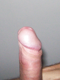 pronto per smorzacandela