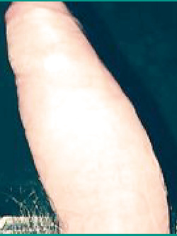 Il mio cazzo Parte 166