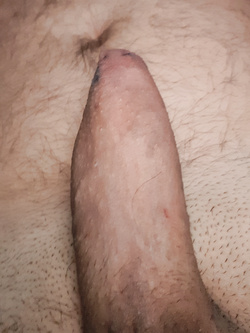 Sempre pronto Parte 2