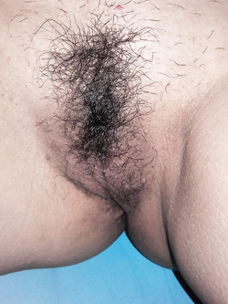 Come la volete... con o senza pelo?