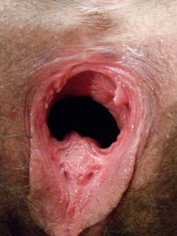 Gran bel buco peloso