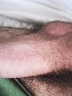 Durello mattutino Parte 2