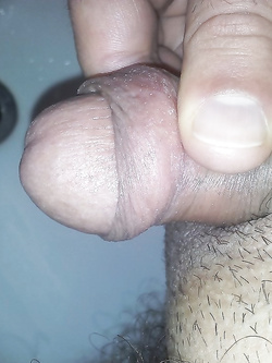 Prove di scappellamento del mio pisellino