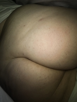 Il mio corpo Parte 6