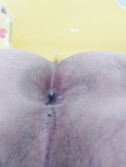 Un'altra parte di me