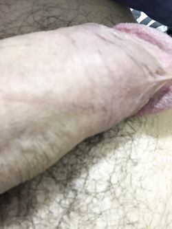 Cercasi bocca di donna...