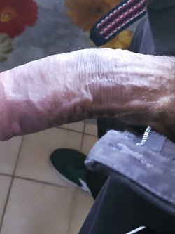 Martino Porcellino 3