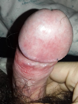 my dick Parte 3