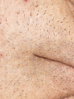 Tributo  a fox19671un