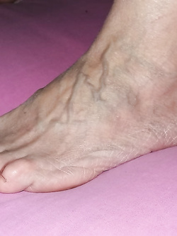 Piedi con piante callose e sporche