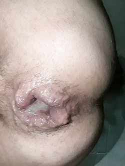 anal cum