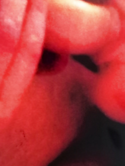 Marta sborratoio (si invita ad pubblicare )