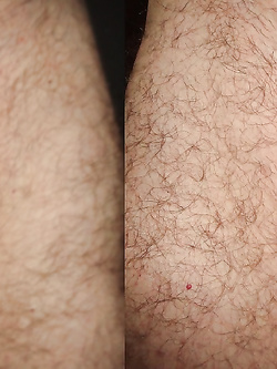 COPERTO O SCAPPELLATO. COME LO PREFERISCI ??