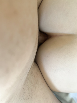 Anale "umido" e corollario...