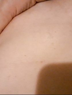 Mia moglie viene visitata da un medico - prima parte