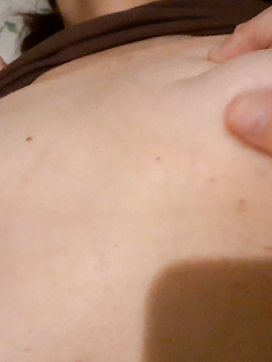 Mia moglie viene visitata da un medico - prima parte