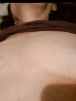 Mia moglie viene visitata da un medico - prima parte