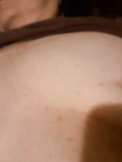 Mia moglie viene visitata da un medico - prima parte