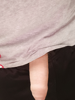 Io prima parte Parte 2