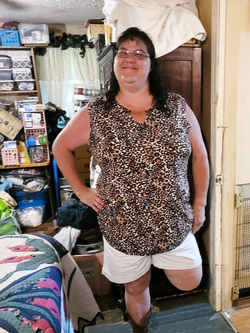 Prepararsi per un ballo, il primo dopo l'amputazione.