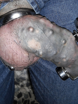 cazzo pene chiuso a chiave in castità