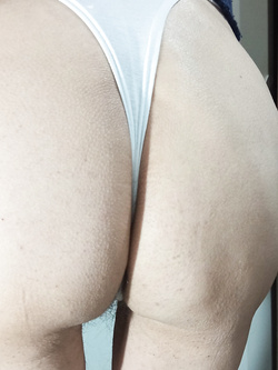 candid ass 2 Parte 2