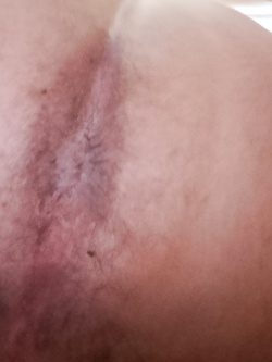 Il mio culo Parte 20