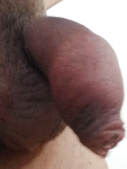 Timido Giovane (piccolo pene?)