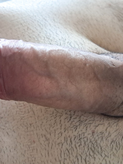 Il mio pisello Parte 20