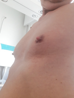 I capezzoli di Pamela trav