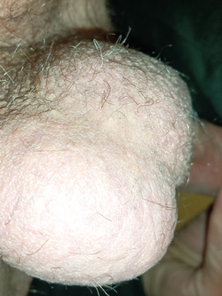 Il mio pene Parte 14