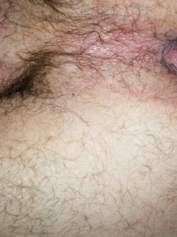 Io, il mio cazzo il culo e la porcona!!!