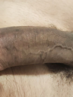 Un po' di me Parte 70