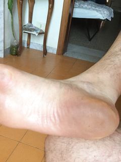 Piedi Parte 4