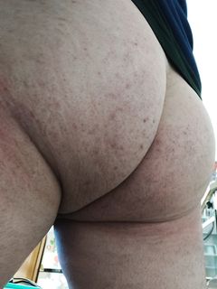 Il mio culetto Parte 10