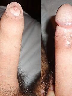 COPERTO O SCAPPELLATO. COME LO PREFERISCI ??